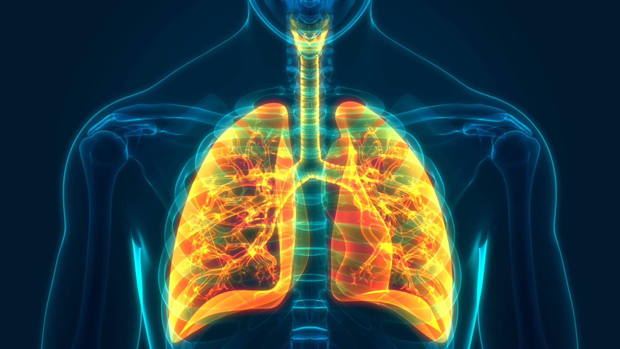 Radon as the second leading cause of lung cancer