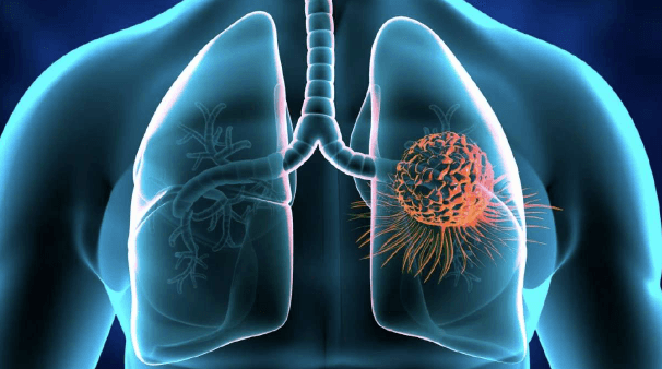 American Lung Association encourages Utah residents to test their homes for radon this month